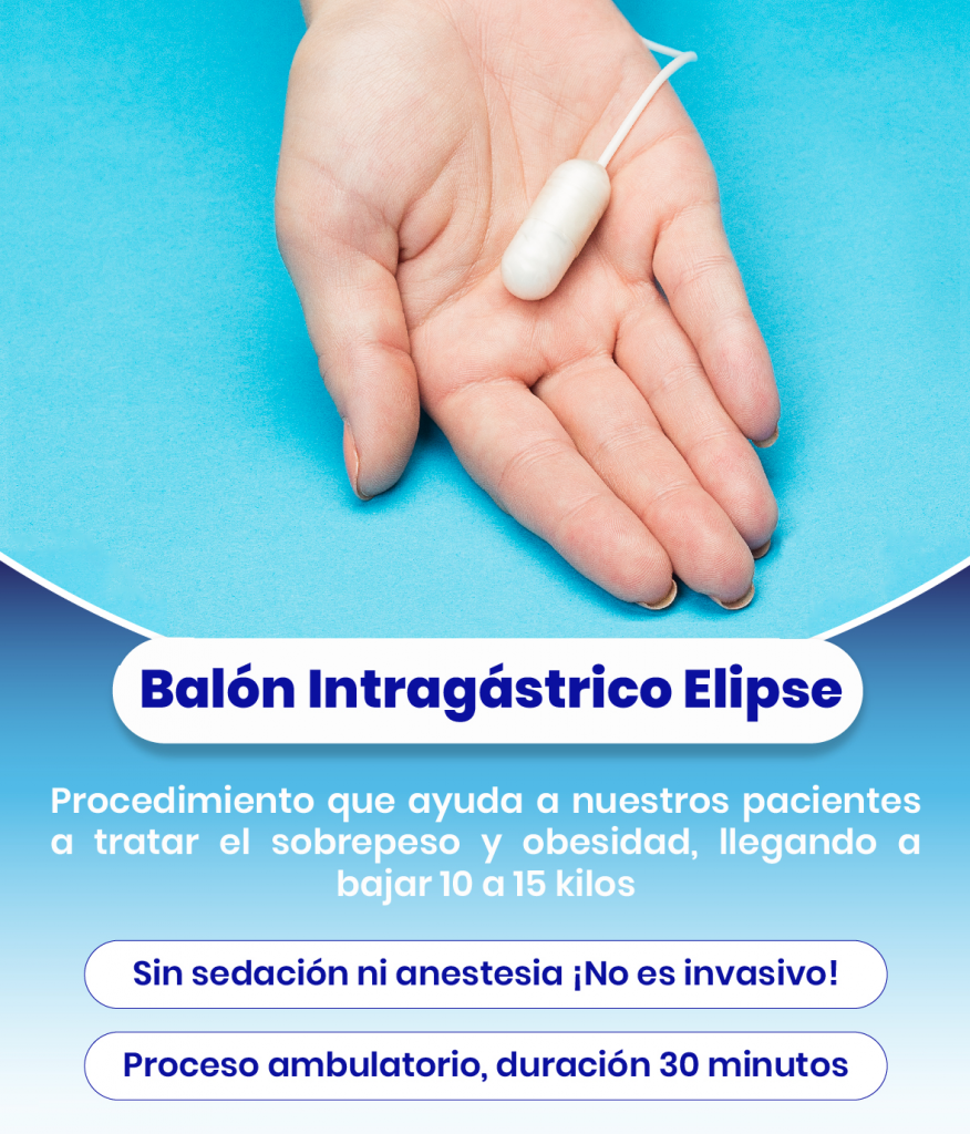 200710_Publicación Balón Intragástrico Elipse RRSS